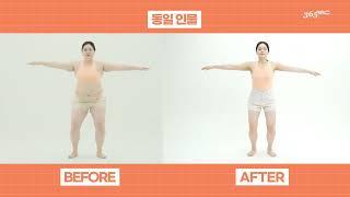 Global Better Me | Miss Thai | Before and After | #liposuction #diet