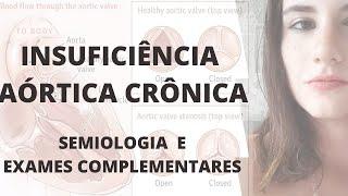 Insuficiência Aórtica - Semiologia e Exames Complementares