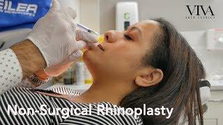 Non-Surgical Rhinoplasty | VIVA Skin Clinics