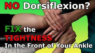 NO Dorsiflexion? Fix the TIGHTNESS In the Front of Your Ankle (Fix Tight Ankles Part 1)