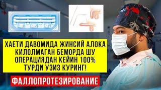 Жинсий заифликни 100% операцияси. Узиз куринг!