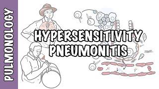 Hypersensitivity pneumonitis