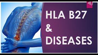 USMLE Step 1 Immunology - HLA-B27 & Associated diseases with Step 1 questions.