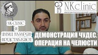 Челюстно-лицевой хирург Назарян Д.Н. Удаление опухоли верхней челюсти с замещением трансплантатом