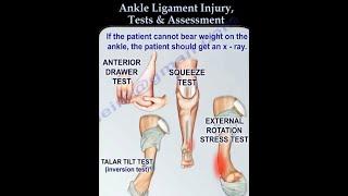 Ankle Ligament Injury, evaluation and tests. - Ankle ligament injury, diagnosis and treatment.