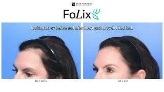 FoLix Laser Hair Restoration