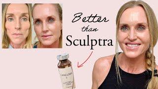 How I finally reversed my Facial Fat/Volume Loss (without Filler) |  Lanluma vs Sculptra