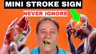 8 Signs of Mini Strokes in Elderly (Transient ischemic attack)