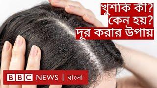 Dandruff: শীতে চুলে খুশকি হয় কেন, দূর করার উপায় কী? | BBC Bangla