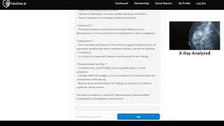 Xray Analyzes In Seconds CareCast.AI