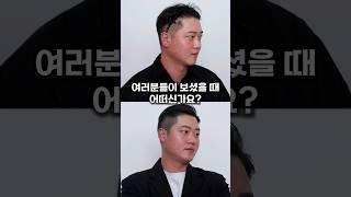 20대 유부남에게 탈모가..?