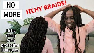 HOW TO COMPLETELY STOP THE ITCH IN YOUR BRAIDS AND PROTECTIVE STYLES|NATURAL 4C HAIR|CAUSES|SOLUTION