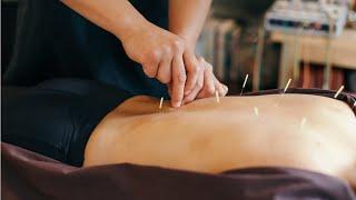 Acupuncturists Career Video