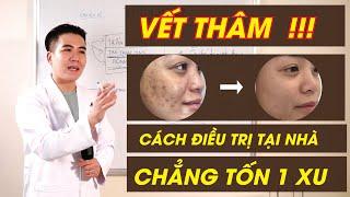 [BÀI GIẢNG DA LIỄU] TRỊ THÂM tại nhà - Đơn giản hơn bạn nghĩ | Thẩm Mỹ Viện Facemax