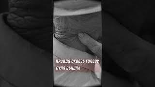 Как белорусский партизан пережил выстрел в голову от офицера вермахта