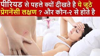 पीरियड से पहले प्रेगनेंसी लक्षण तो दीखते है मगर गर्भ नहीं रुकता है| Premenstrual syndrome symptoms