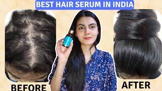 How I Regrew My Hair in just 28 days | Pilgrim Hair Growth Serum #hairtransformation #hairserum