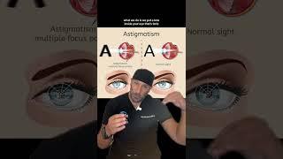 Unlock Clear Vision Astigmatism and Vision Correction Surgery! ️ #astigmatism  #vision  #lasik