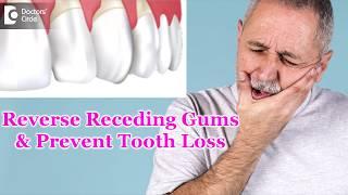 Will my teeth fall out of receding gums?What to do? - Dr. Rizwana Tarannum