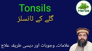 Tonsils | گلے کے ٹانسلز کا علاج | بچوں اور بڑوں کے ٹانسلز کا علاج | Hakeem Zia ur Rehman