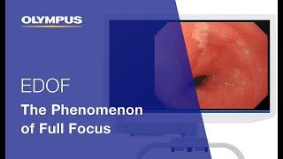 EDOF: The Phenomenon of Full Focus | EVIS X1 | Gastroenterology | OLYMPUS