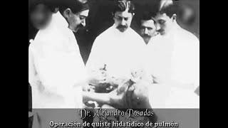 1899 - Operación de quiste hidatídico de pulmón (Pulmonary hydatid cyst operation) - Eugèni Py