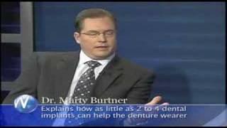 Dr. Marty Burtner on the Wellness Hour - Oral Implants (2/4)