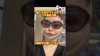【韓国美容】痛くてもやって良かったプチ整形3選‼️#ヒアルロン酸 #ボトックス