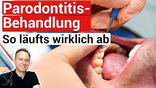 So läuft eine Parodontitisbehandlung wirklich ab️