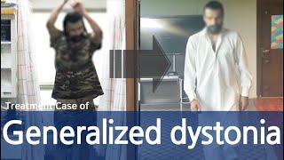 Generalized Dystonia / Cervical dystonia, Dysphonia, Oromandibular dystonia / 전신 디스토니아 치료사례 / 근긴장이상증