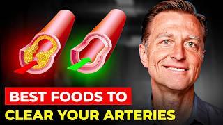 Dr. Eric Berg's SHOCKING Foods That Clean Your Arteries! What Doctors Won't Tell You!