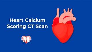 Heart Calcium Scoring CT Scan – Memorial Cardiac and Vascular Institute