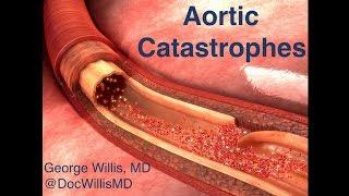 Aortic Emergencies: Dr George Willis at #stemlynsLIVE