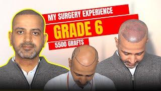 Hair Transplant in Pune | Best Results & Cost of Hair Transplant in Pune