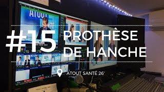 [Atout Santé #15] Tout savoir sur la prothèse de la hanche