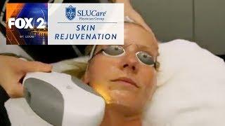 Skin Rejuvenation - SLUCare Health Watch