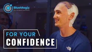 Adam traveled from UK to Istanbul for his BEST hair transplant option | BlueMagic Group Reviews