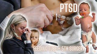 SURGERY VLOG | FEEDING TUBE FOR OUR DISABLED TODDLER *EMOTIONAL + PTSD*