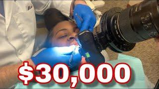 $30,000 NEW TEETH MAKE OVER !!! (PROCESS)