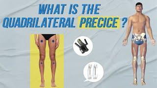 WHAT IS THE QUADRILATERAL PRECICE LENGTHENING?