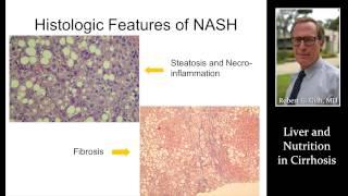 LIVER & NUTRITION IN CIRRHOSIS by Dr. Robert Gish