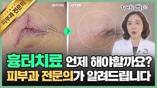 흉터가 남지 않게 하려면? '이때'가 치료 골든타임!