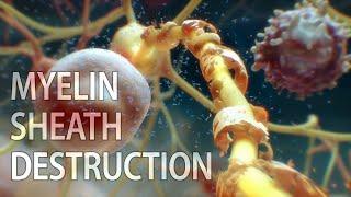 Multiple sclerosis (MS) animation | myelin sheath destruction | medical animation | MS animation