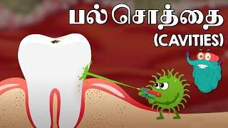 பல் சொத்தை | What Causes Cavities | Dr. Binocs Tamil | Best Learning Videos For Kids