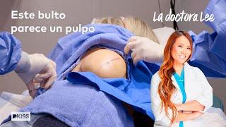 La doctora Lee extirpa un bulto, ¡y el interior del quiste parece pollo! | La doctora Lee