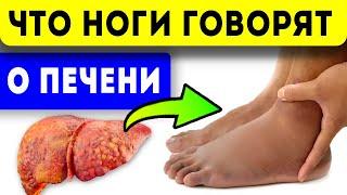 7 симптомов на ногах, которые расскажут о заболеваниях печени!