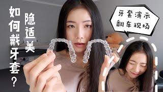 【隐适美】【Invisalign NZ】超详细的隐适美使用说明！配戴演示以及“翻车”现场