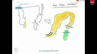 CCC Surgery Basics - Bowel Prep - Ramanuj Mukherjee