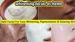 Dahi Facial For Glowing Skin | That Remove Pigmentation & Dark Spots - Lightnes Dull Dark Skin