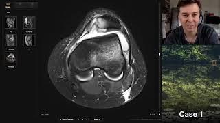 Isolation tutorial: Knee MRI with Andrew Dixon